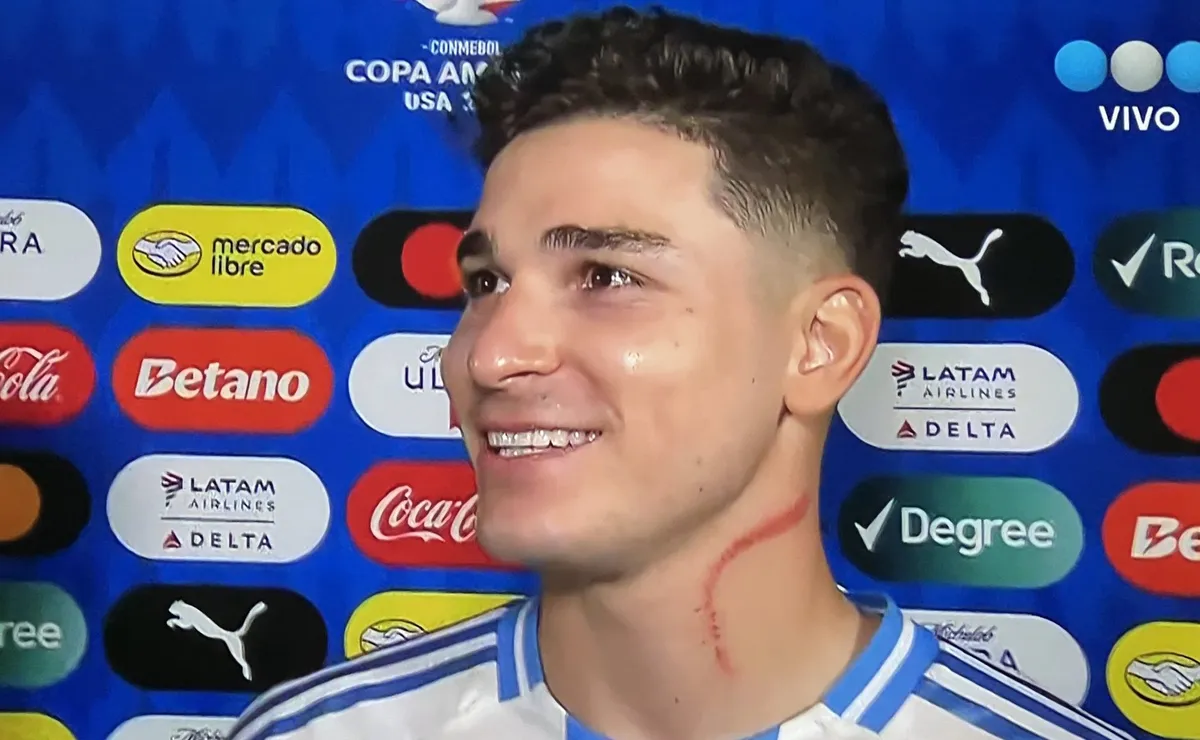 Así le quedo el cuello a Julián Álvarez (Foto: Captura TV Telefé).