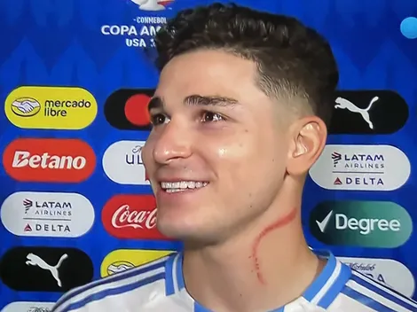 Qué le pasó en el cuello a Julián Álvarez en la victoria ante Canadá