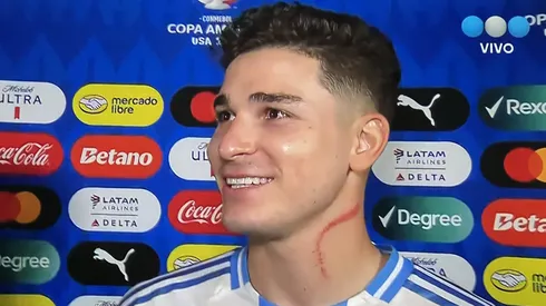 Así le quedo el cuello a Julián Álvarez (Foto: Captura TV Telefé).