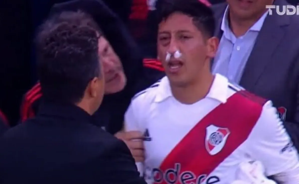 La imagen de Rodrigo Aliendro luego del golpe en su rostro.