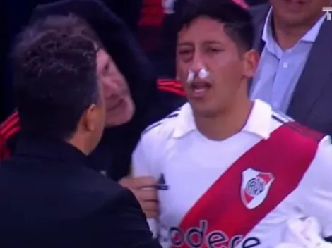 Aliendro sufrió una fractura y será operado