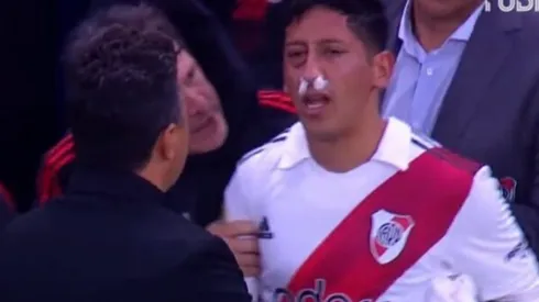 La imagen de Rodrigo Aliendro luego del golpe en su rostro.