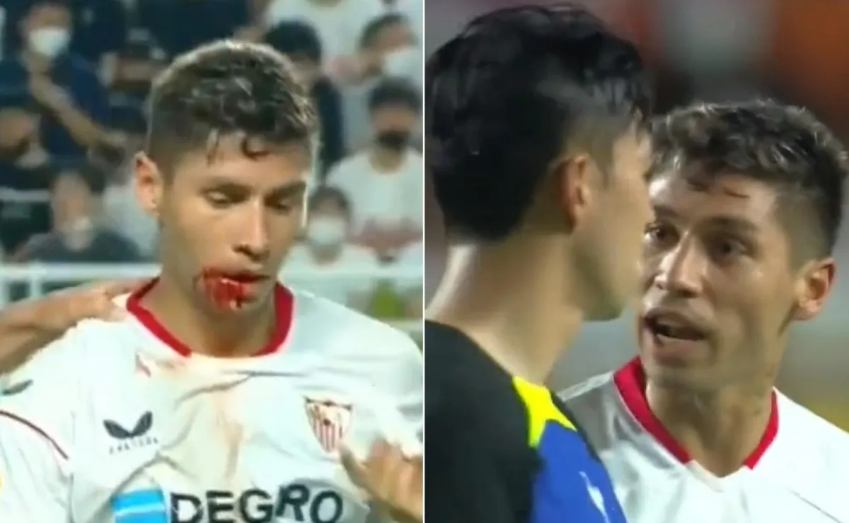 Gonzalo Montiel, herida y bronca con el futbolista del Tottenham.