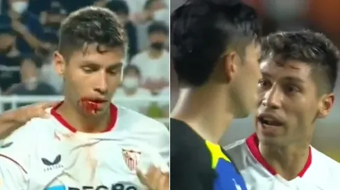 Gonzalo Montiel, herida y bronca con el futbolista del Tottenham.