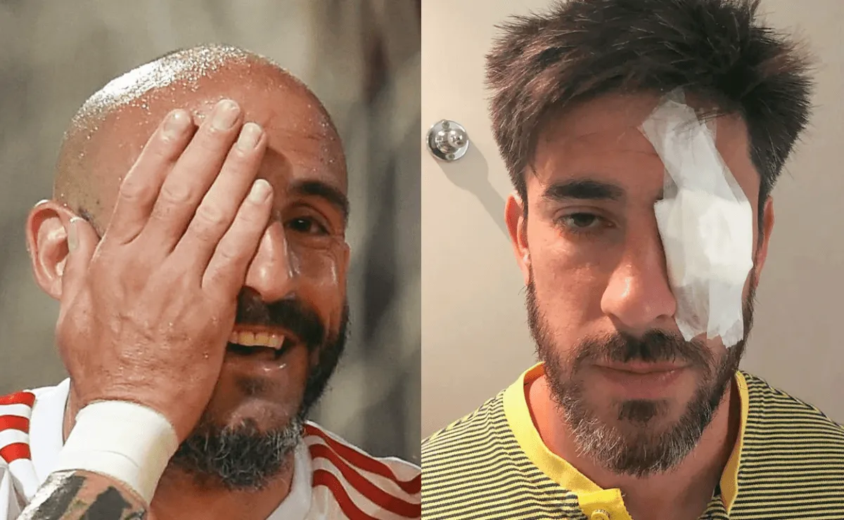 El defensor de River festejó el primer tanto del partido ante Estudiantes tapándose uno de sus ojos.