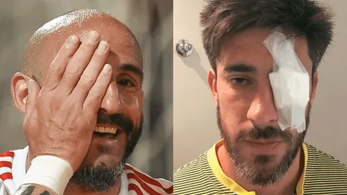 El defensor de River festejó el primer tanto del partido ante Estudiantes tapándose uno de sus ojos.