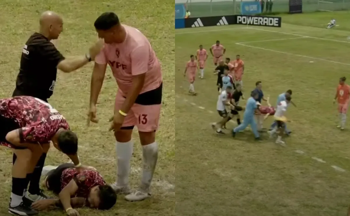 Conmoción en la Copa Potrero: Nicolás Bertolo fue retirado inconsciente de la cancha
