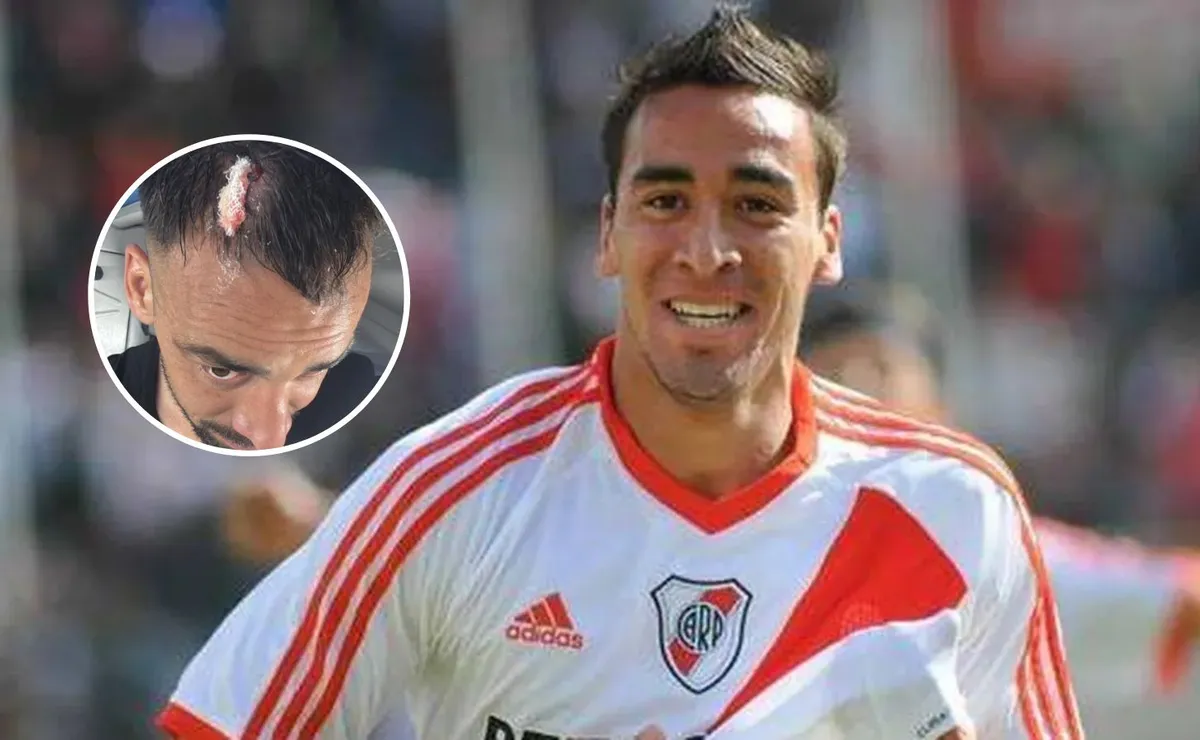 El ex River que vivió un calvario en el Federal A: herido por un piedrazo y "nos robaron el partido"