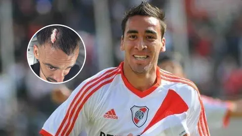 El ex River que vivió un calvario en el Federal A: herido por un piedrazo y "nos robaron el partido"