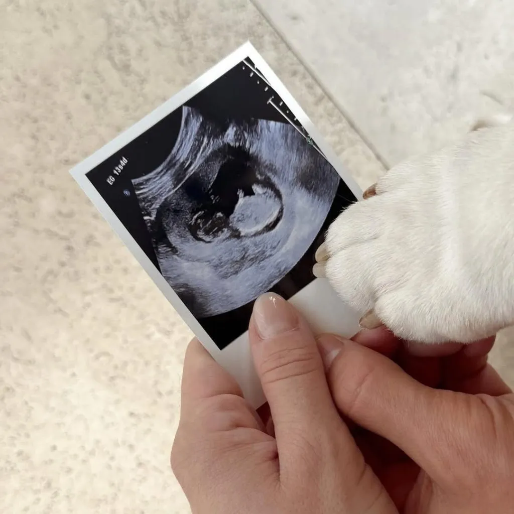 La ecografía publicada por Gattoni.