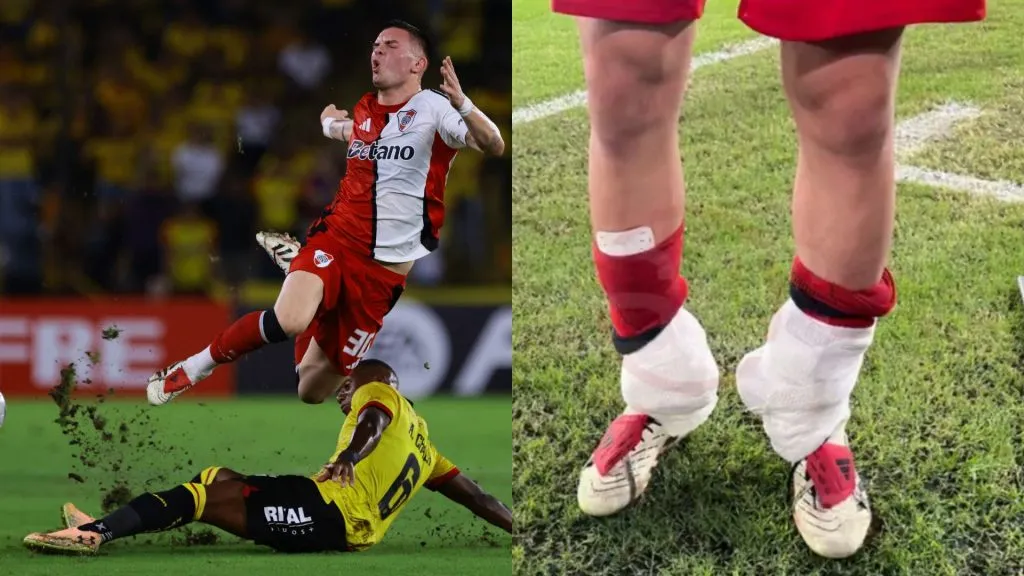 La imagen de Mastantuono con hielo en sus tobillos.