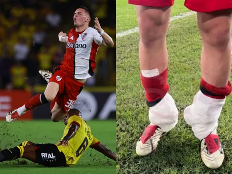 Qué le pasó a Mastantuono: la fuerte imagen de sus dos tobillos con hielo