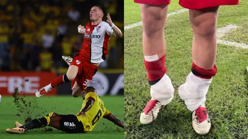 La imagen de Mastantuono con hielo en sus tobillos.