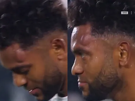 No se vio: por qué Borja terminó el partido con un chichón inmenso en la cabeza