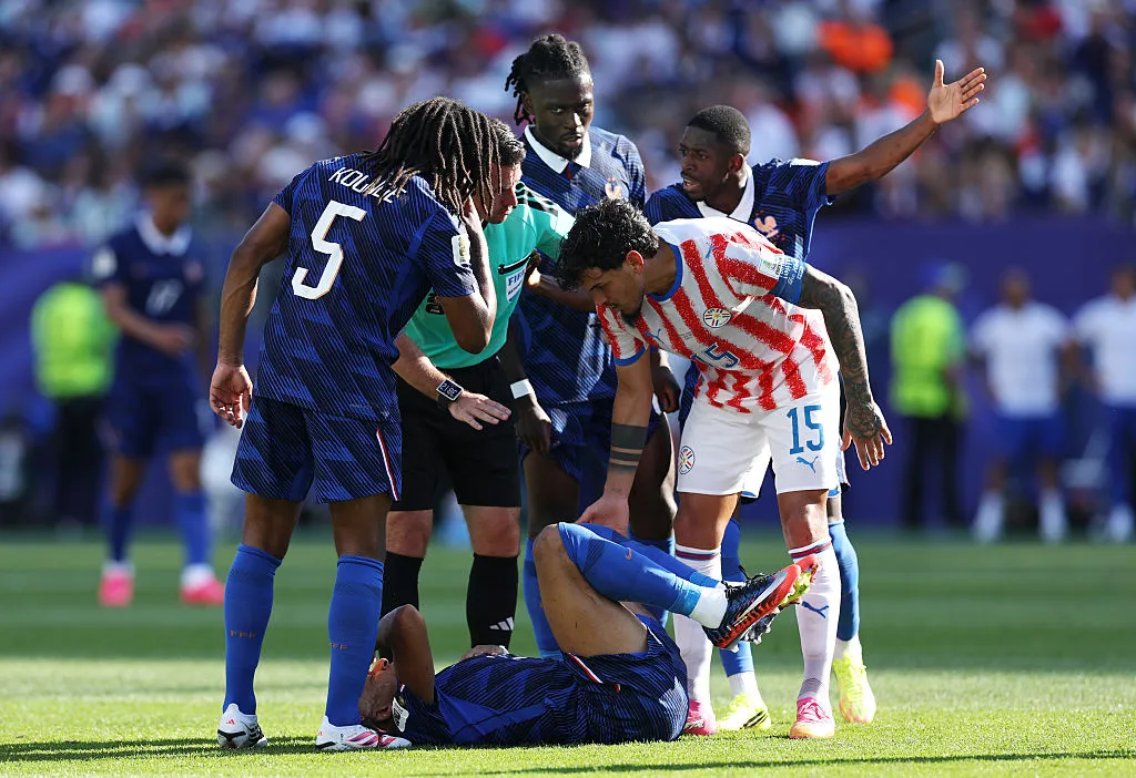Así quedó Mbappé tras el manotazo de Galarza Fonda. (Getty Images)